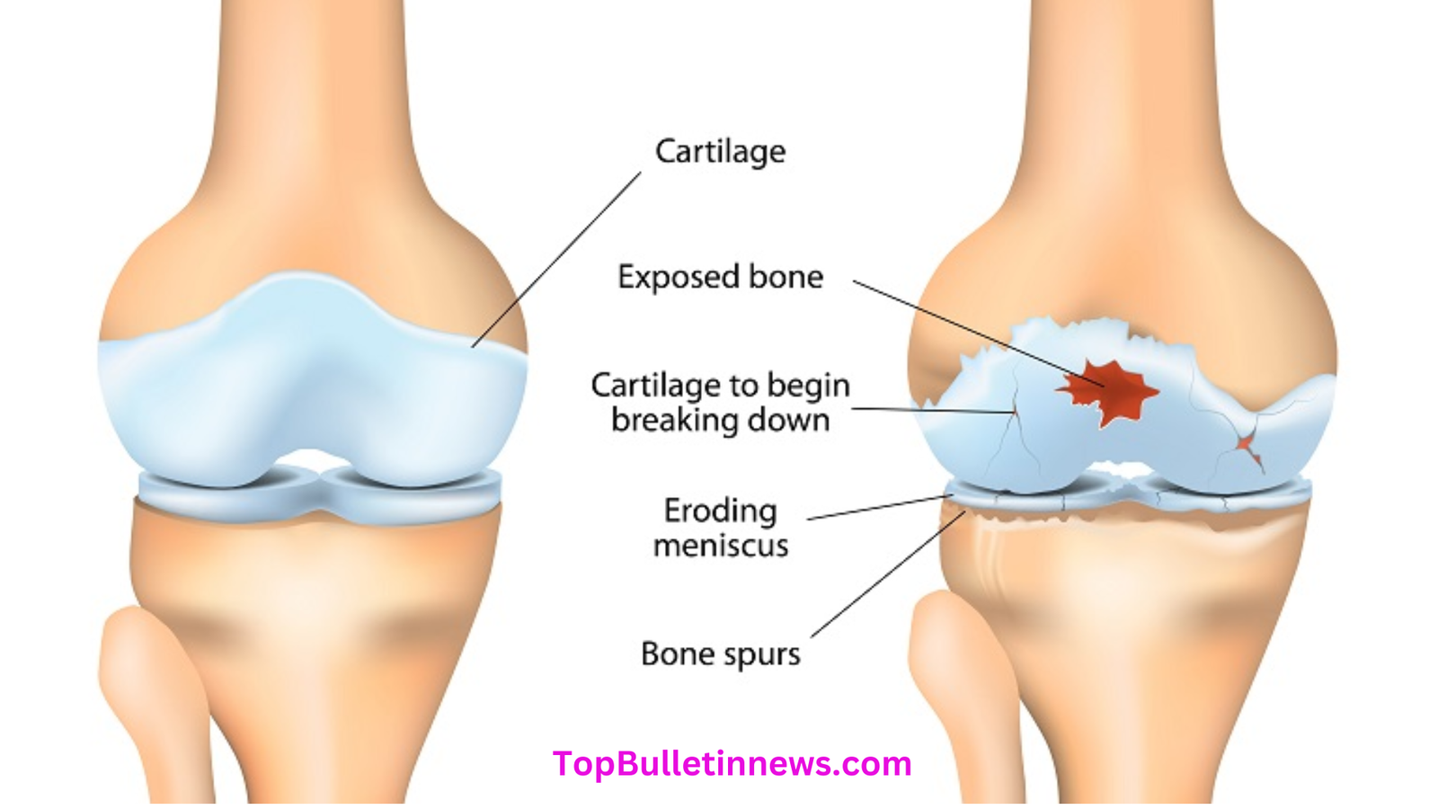 Leg Pain symptoms