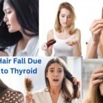 Hair Fall Due to Thyroid