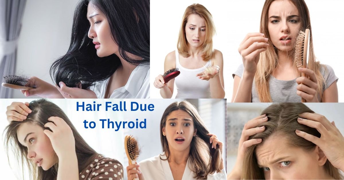 Hair Fall Due to Thyroid