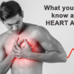 Heart attack symptoms and treatment