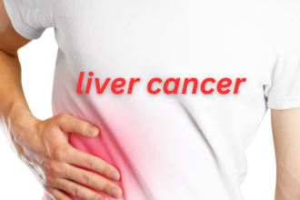 Stage 4 liver Cancer