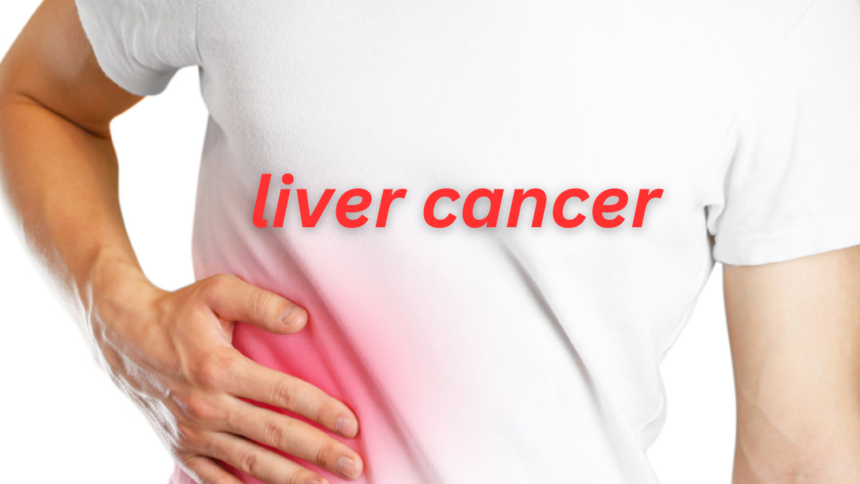 Stage 4 liver Cancer